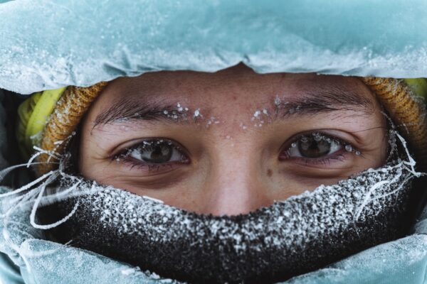 Winter Makes Eyes Irritated and Dry: Experts Reveal Healthy Vision Secrets to Combat Cold Weather Winter Makes Eyes Irritated and Dry Experts Reveal Healthy Vision Secrets to Combat Cold Weather